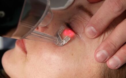 Procedemento de rexuvenecemento da pel facial con láser